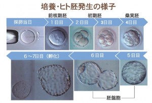 日本英医院生殖中心的日本试管婴儿技术