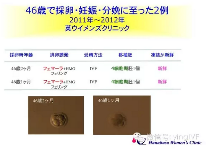 日本英医院生殖中心日本微刺激试管婴儿技术