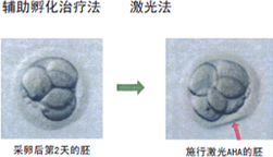 前培养技术，改善幼弱和老化卵子