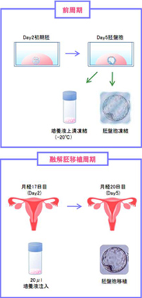 SEET（薄膜）移植法