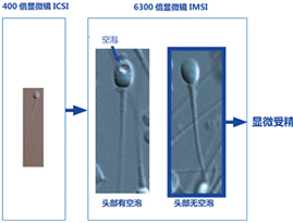 IMSI 6300倍显微镜辅助的显微受精