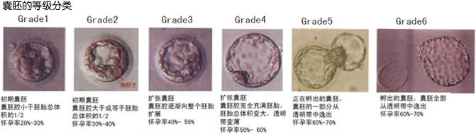 囊胚的等级分类