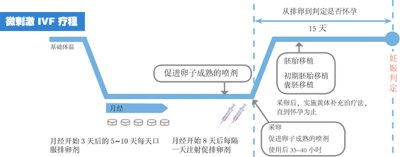 IVF 微刺激促排法