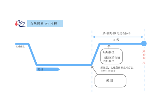 IVF 自然周期法